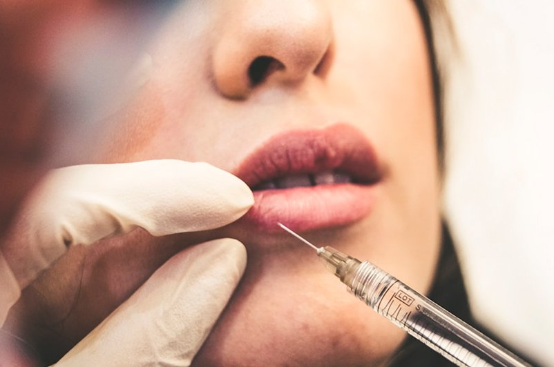 Botox: The Gold Standard in Wrinkle Prevention and Treatment