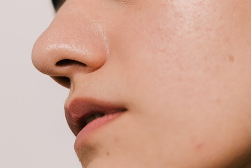 Profhilo: The Injectable Skincare Revolution